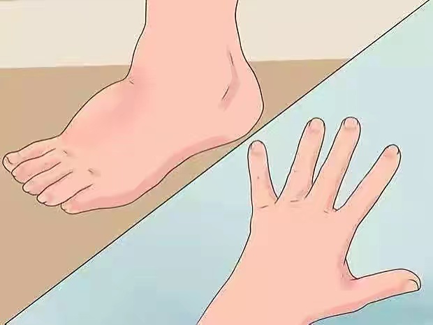 孕期腰部不适怎么办,孕妇下肢发硬怎么回事