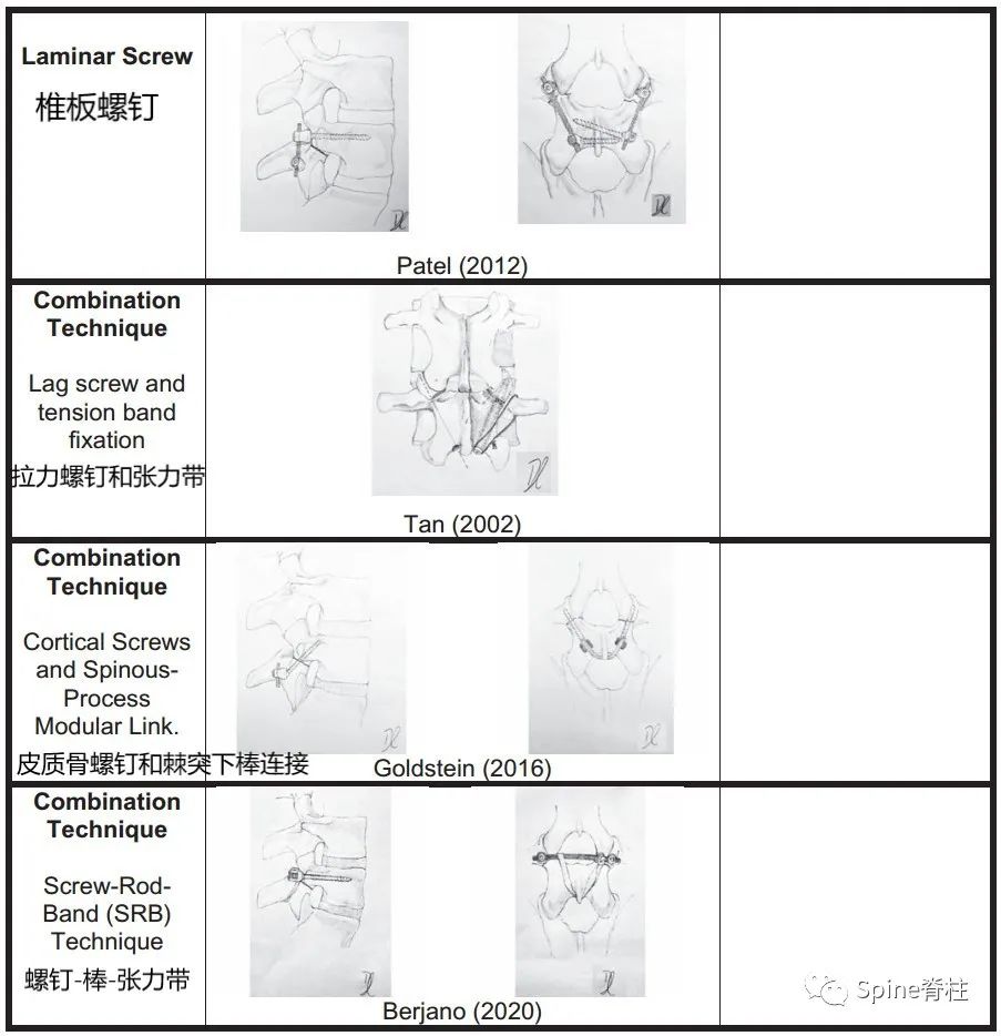 峡部裂和隐性峡部裂有区别吗,单纯峡部裂可以做峡部修复吗