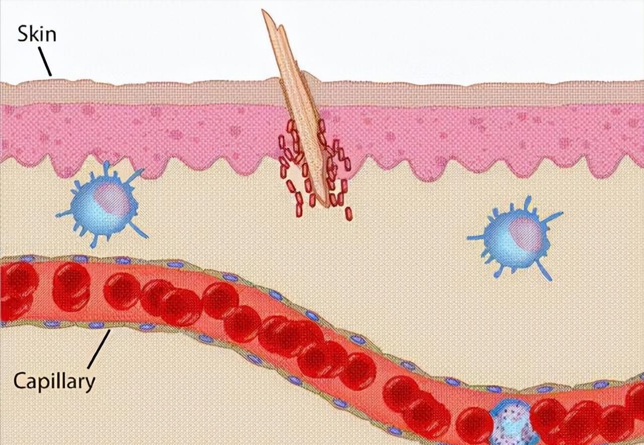 新龙甘消炎膏对痔术后疼痛及水肿的相关效性随机对照临床试验