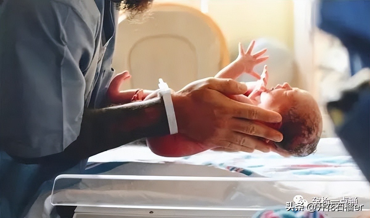 新生儿这5大状况你最担心哪个,新生儿有些表现不用治您知道吗