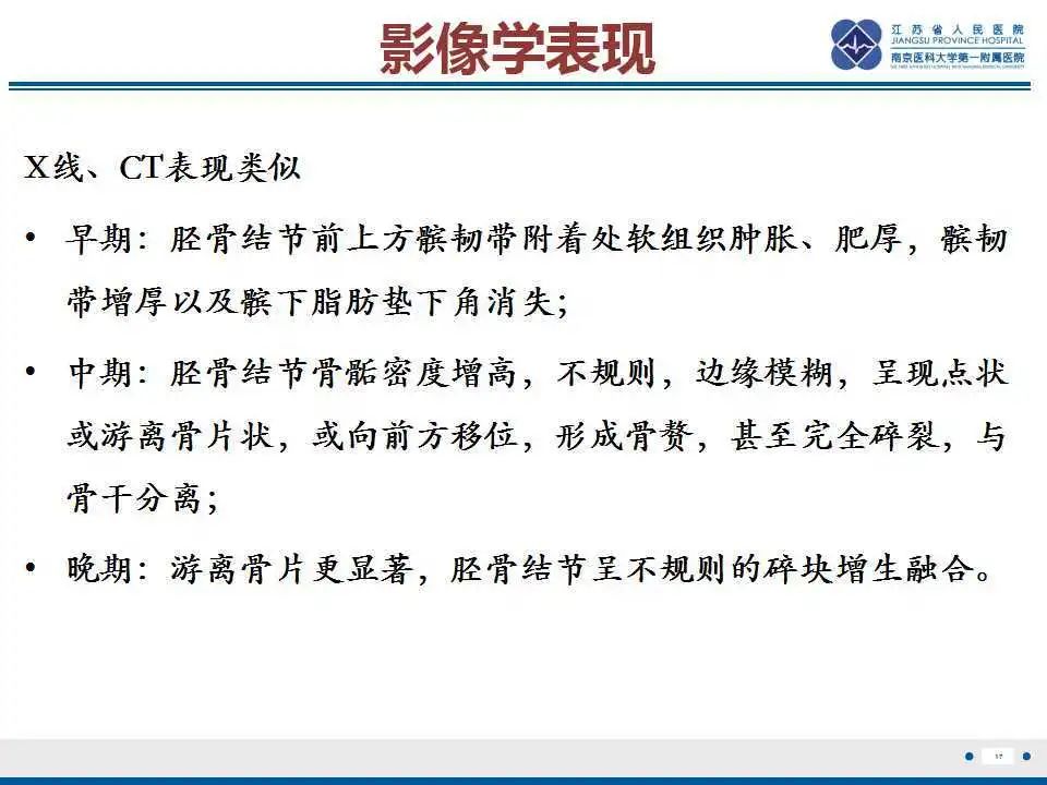 胫骨结节软骨炎要怎么治疗,胫骨结节骨软骨炎会癌变吗