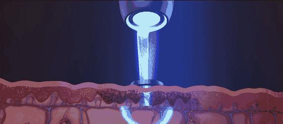 女星护肤祛斑视频,女明星祛斑最快的方法