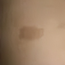 新生儿有胎记怎么办,新生儿有胎记是怎么造成的