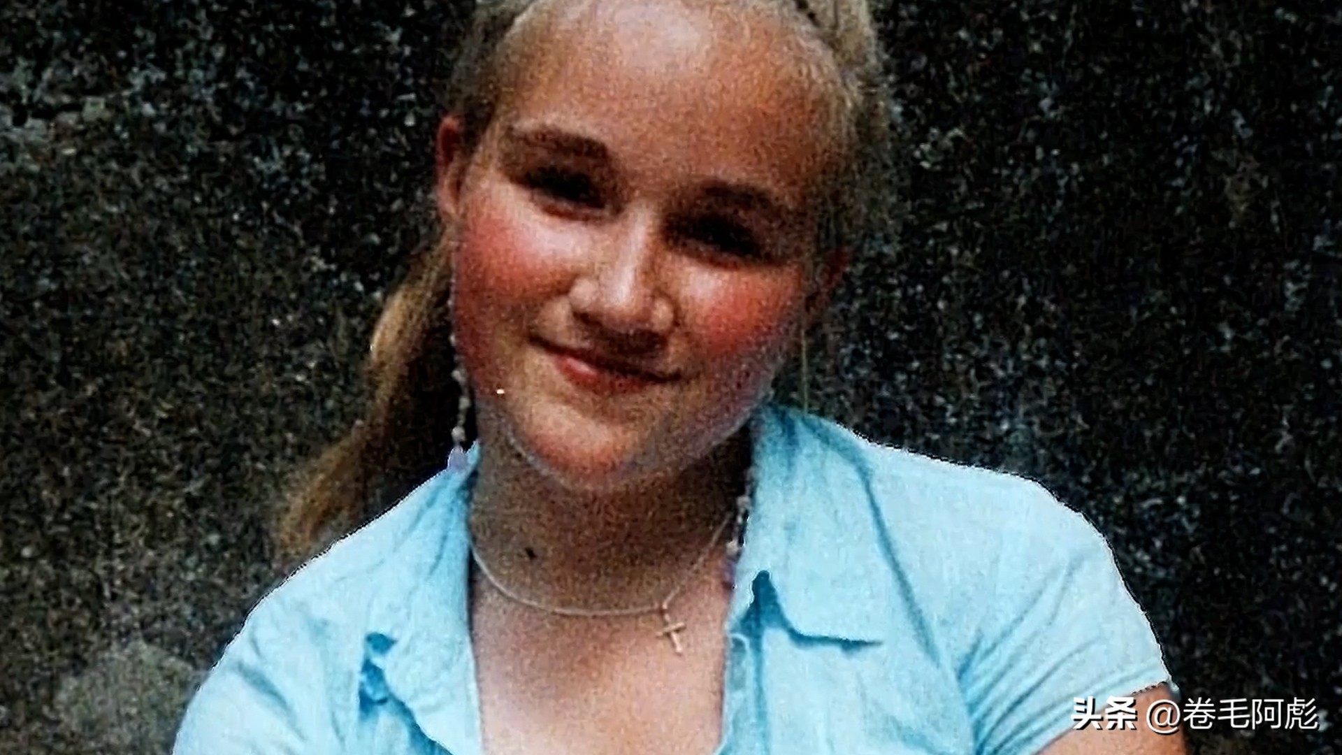 女子被12只蜱虫咬,美国女子被虫子咬