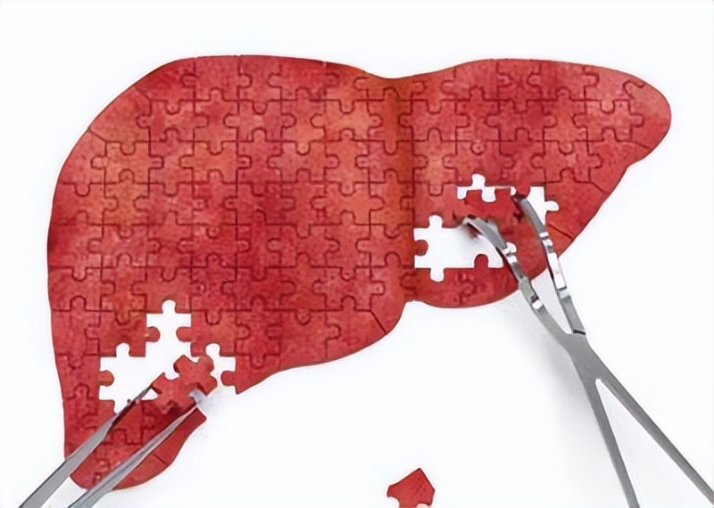出现肝掌肝硬化的几率大吗,肝健康科普图文