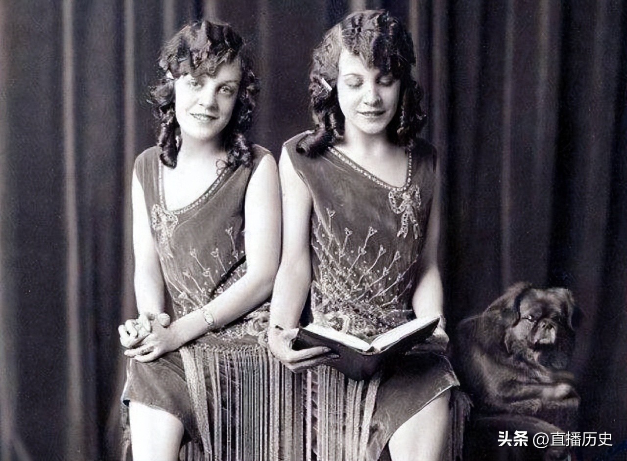 臀部连体姐妹：各有一名丈夫，姐姐死后，妹妹与遗体共存2天去世