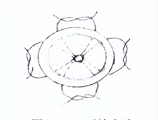 派特灵生物讲解,派特灵用在宫颈的步骤