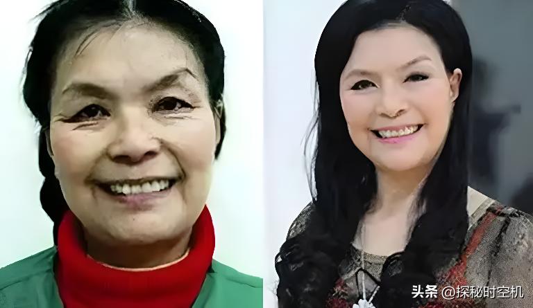 67岁英国太婆隆胸,67岁外国太婆隆胸