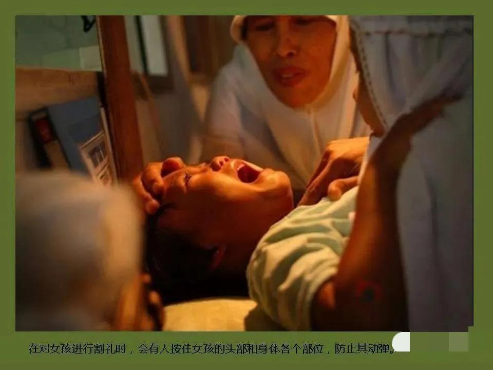 非洲惨无人道的女性割礼，上亿女性惨遭荼毒，究竟何时才能消失？