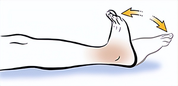 足部手术后肿胀如何处理,足部手术后肿胀发紫怎么消除