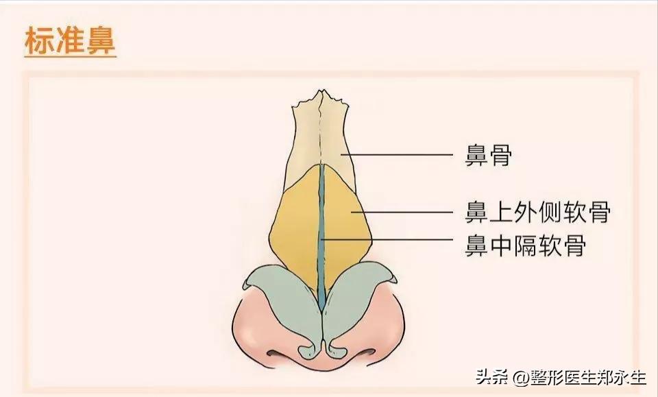 塌鼻和歪鼻如何处理,歪鼻原因