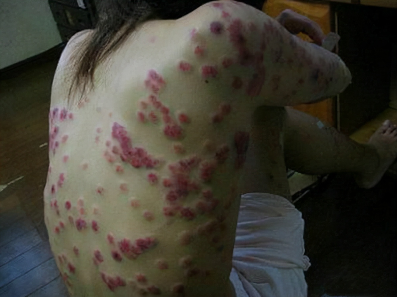 预防艾滋病最好方法改变危险行为,发生高危后如何排除艾滋