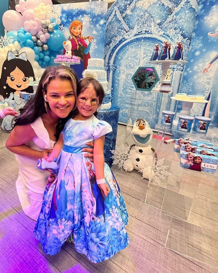 美国小女孩脸带“蝙蝠侠”黑印,治疗两年经过终于恢复肉色!