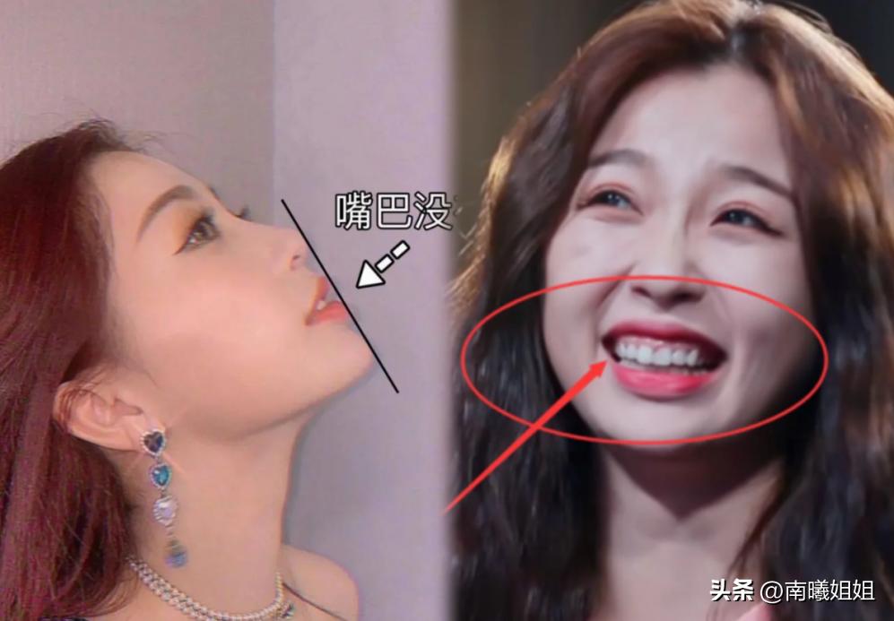 蒜头鼻却很漂亮的原因,蒜头鼻是真的影响颜值