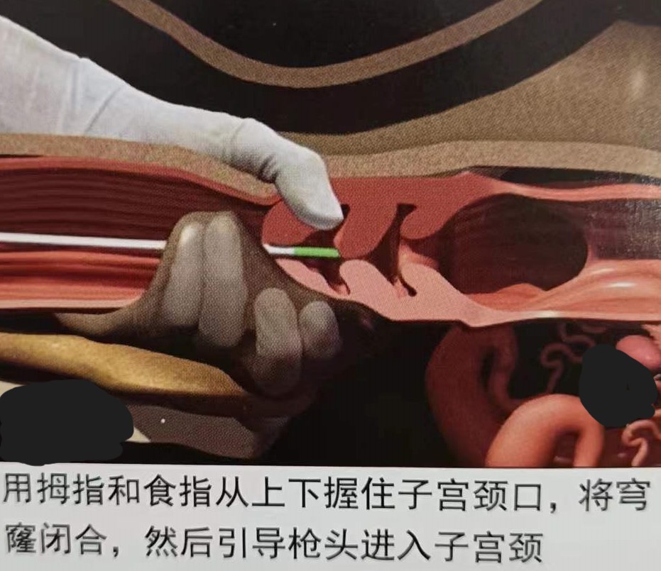 如何提高母牛同期的繁育能力,如何提高母牛受孕率