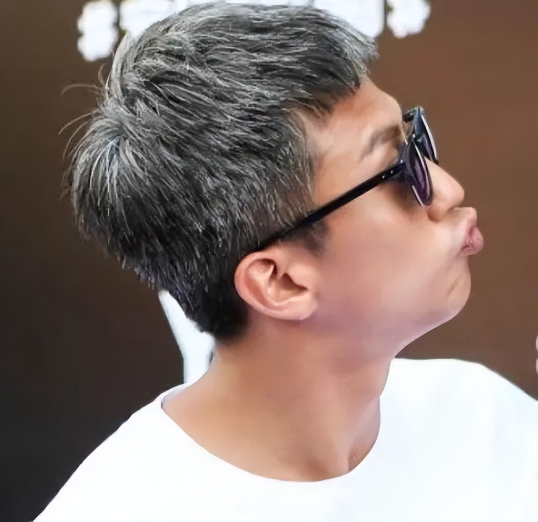 为什么越来越多的年轻人长白头发,年轻人长白发的原因及治疗方法