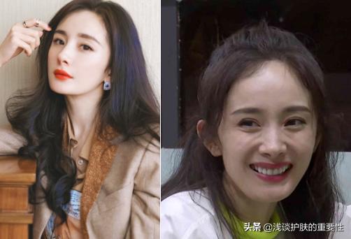 去掉眼纹会不会更显年轻,有眼纹和眼袋哪个更显老