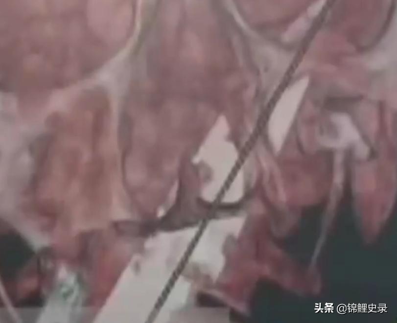 云南男子口臭骇人医生检查惊呼,云南男子口臭传奇故事