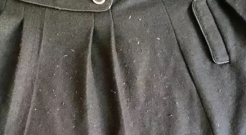 衣服上的毛絮怎么洗掉,衣服洗完好多毛毛如何去除