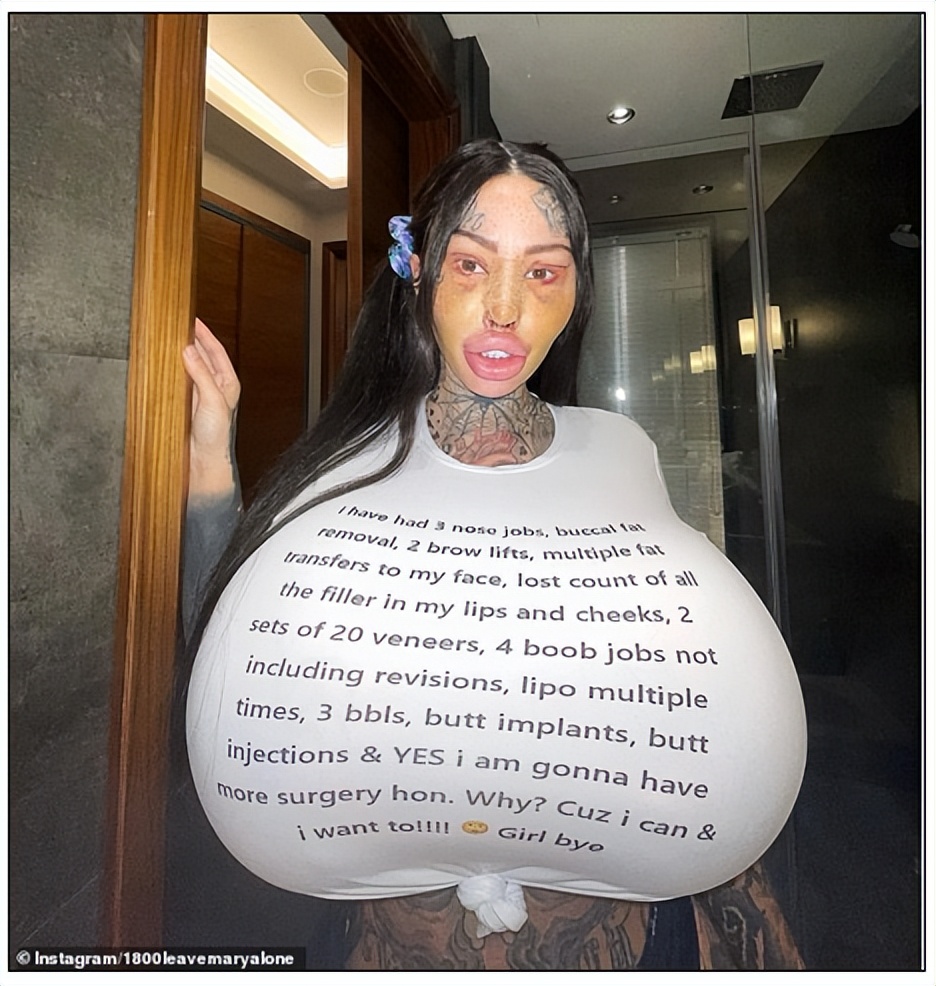 画面太辣眼...网红沉迷整形，因10公斤“假乳”被赶下飞机