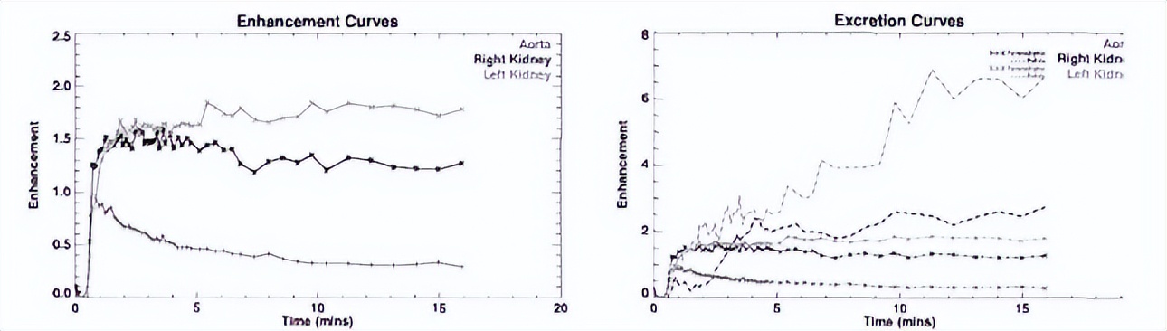 中医治疗宝宝肾积水输尿管狭窄,小儿肾积水和输尿管扩张怎么治疗