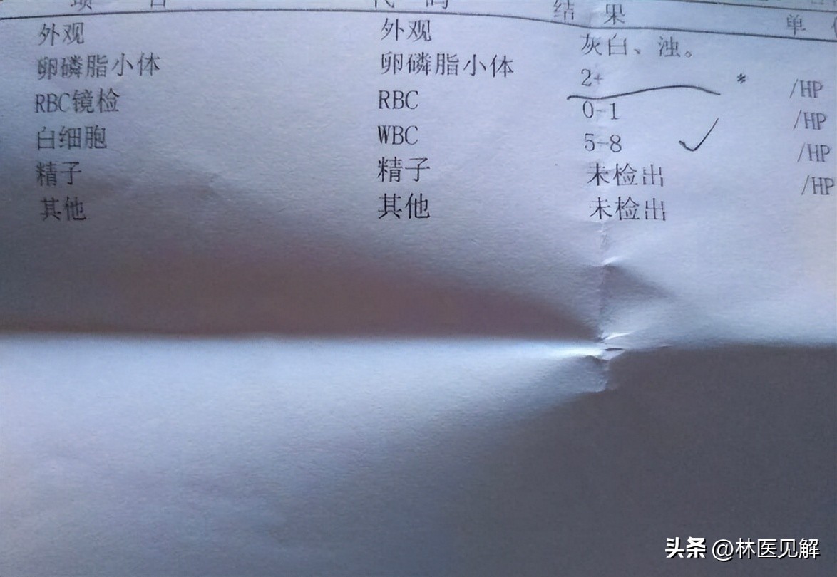 前列腺炎寒湿淤堵,气血淤阻前列腺炎