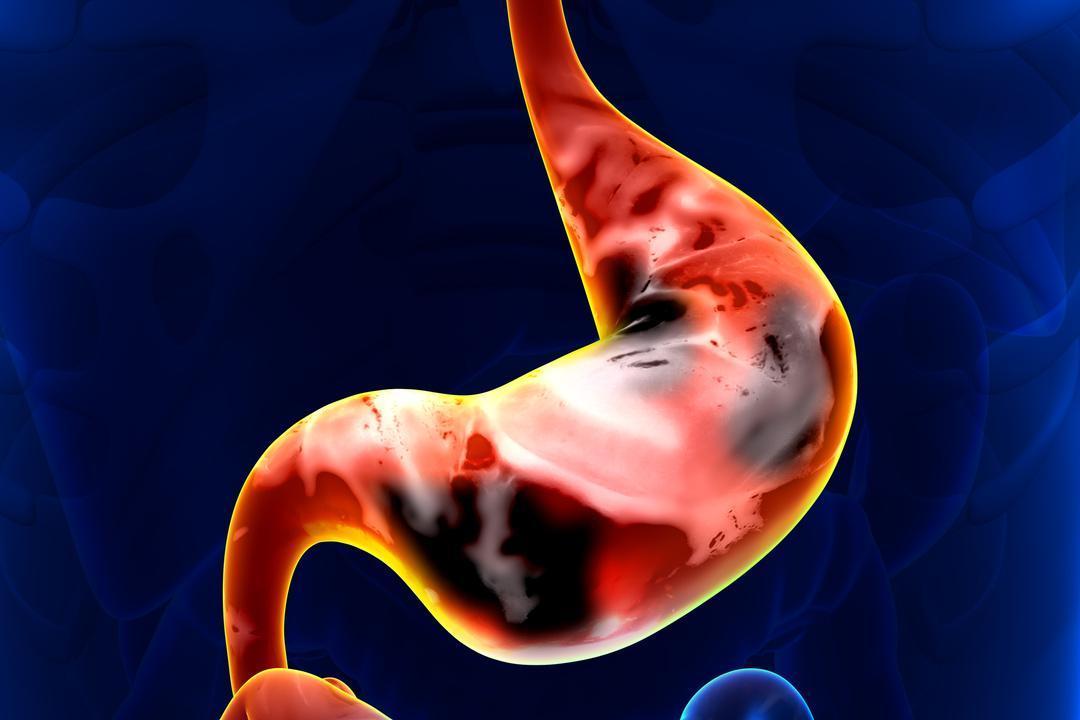 车前草的最大好处,车前草都管啥作用