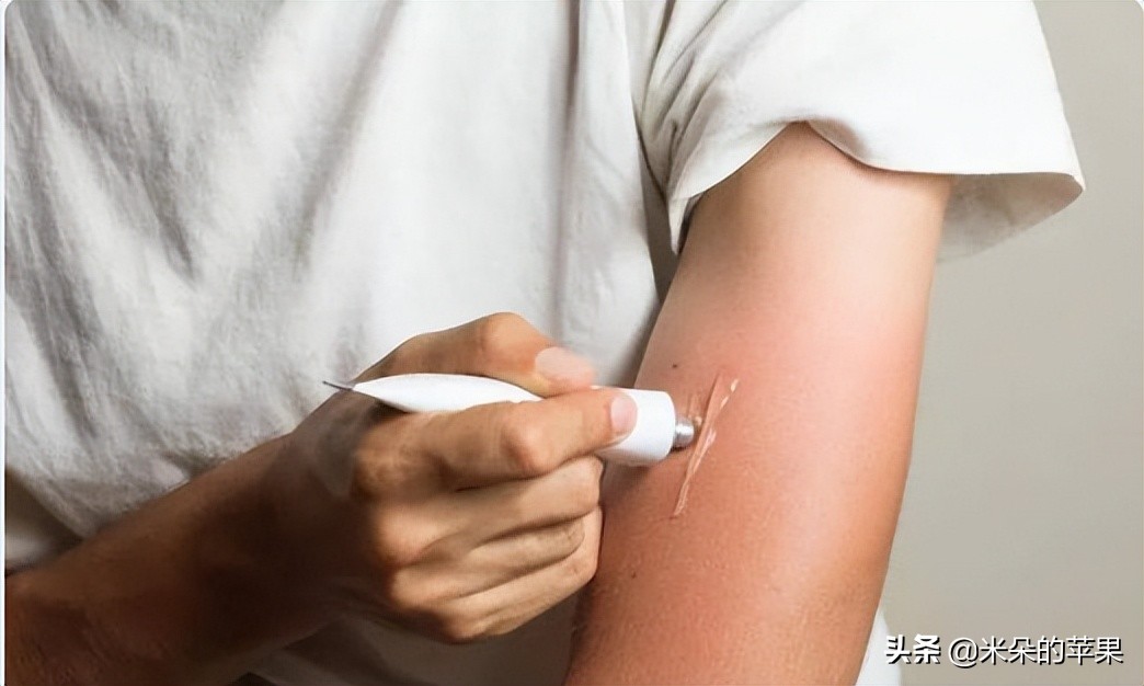 孩子被蚊子咬了很痒怎么办,孩子被蚊子咬痒得厉害怎么办