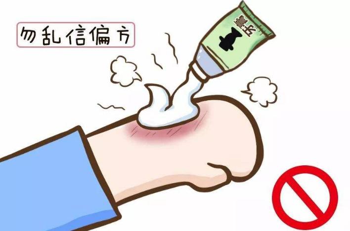 孩子被开水烫伤了该如何紧急处理,小孩被热水烫伤了该怎么处理