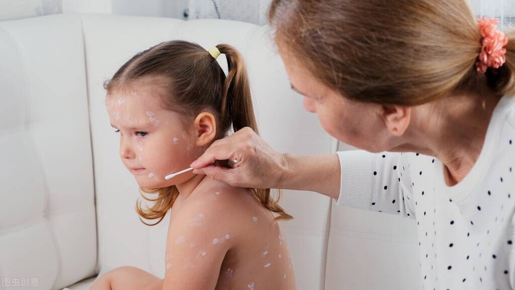 疱疹和水痘的区别是什么,单纯疱疹与水痘带状疱疹的鉴别