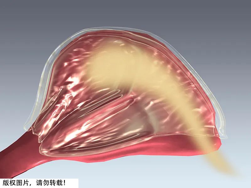 在小小的耳朵里挖呀挖呀挖？快住手，这样挖可能让你悔断肠…