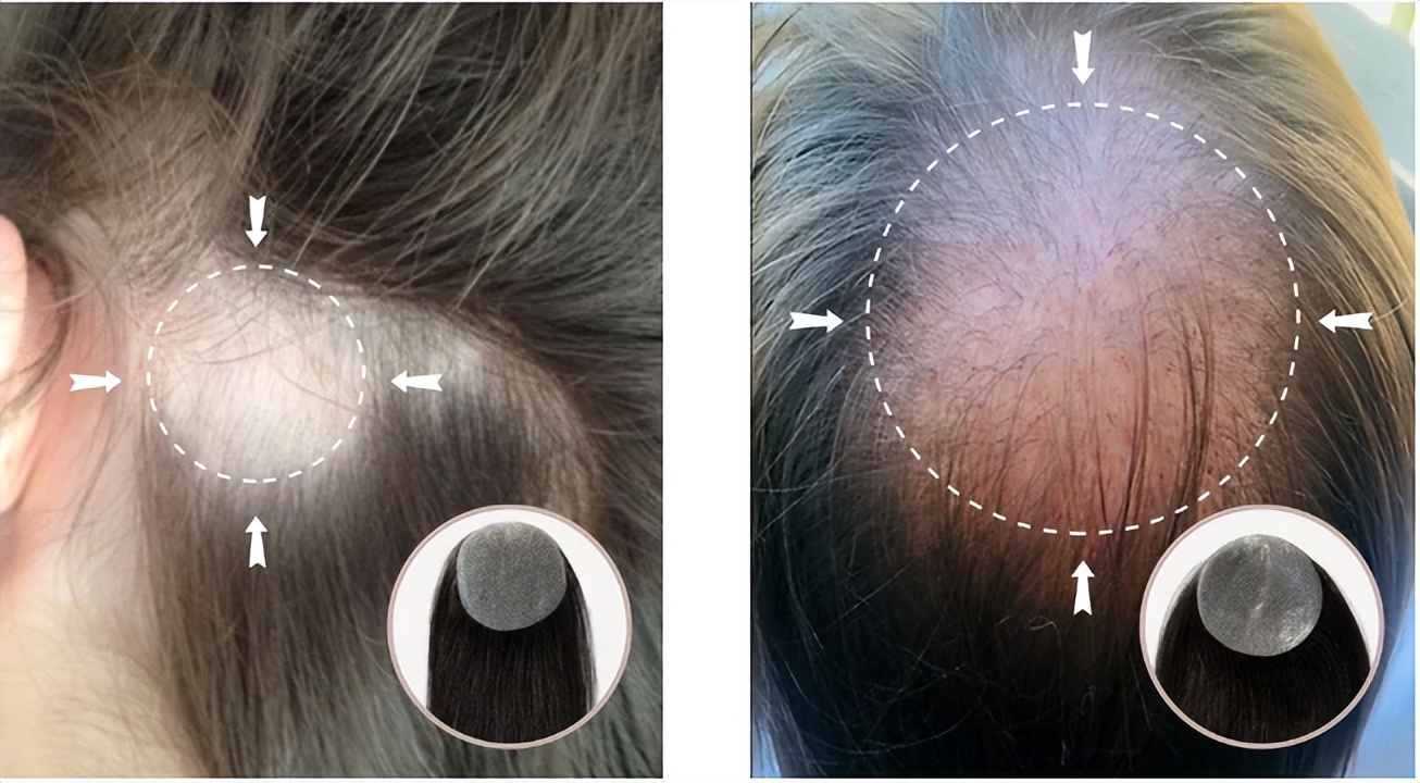头发少的优雅发型,半分钟搞定气质减龄发型