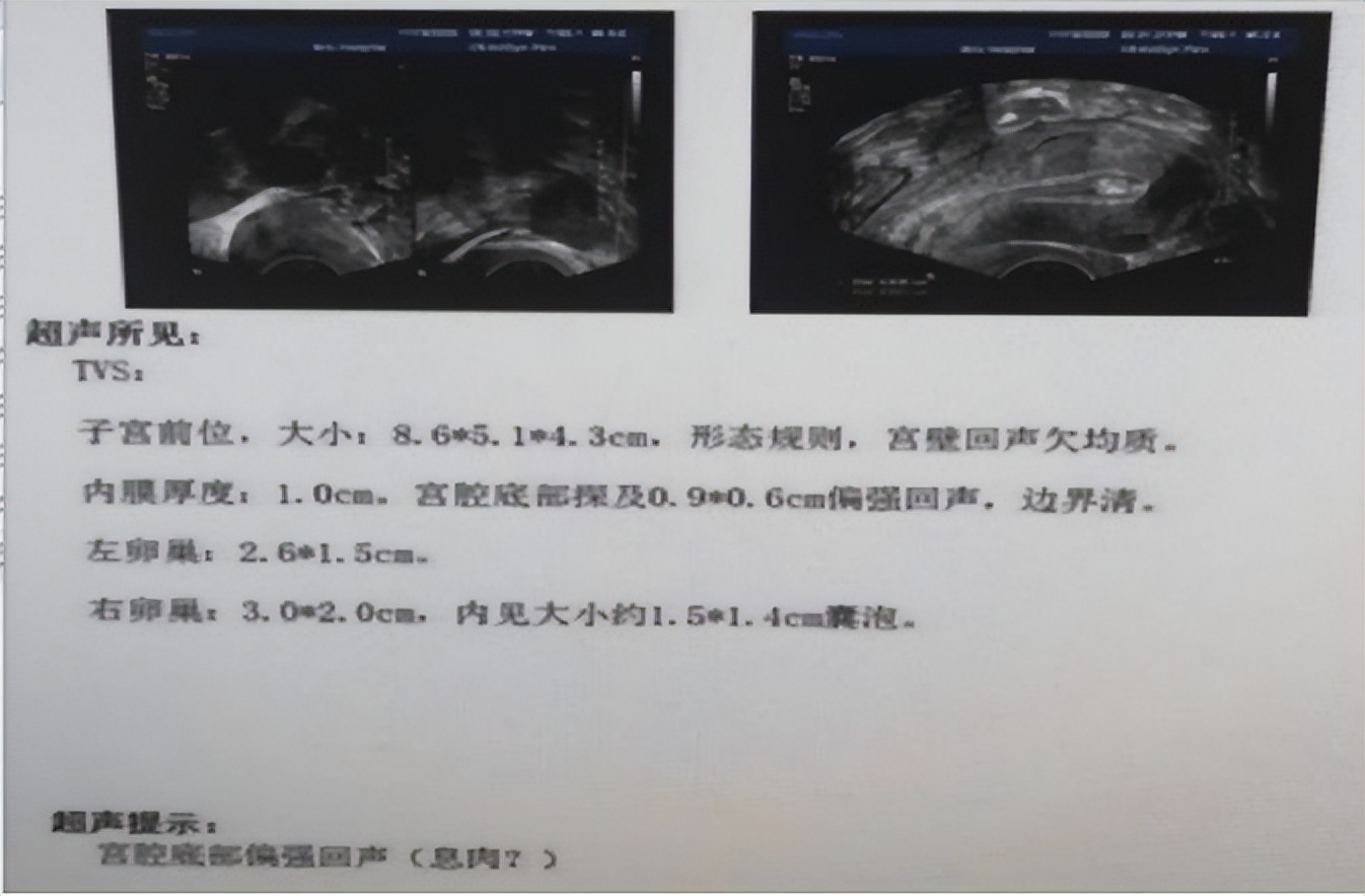 阴道流血不等于月经！异常出血去医院，千万别不当回事