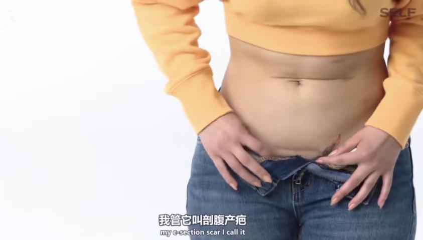 香港富豪丈母娘换肾,香港富豪三亿换肾是在哪个医院