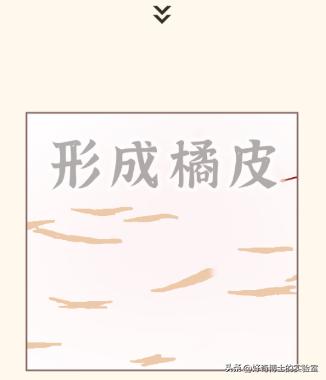 大腿上有白色条纹怎么回事,女生大腿外侧有红条纹是什么原因