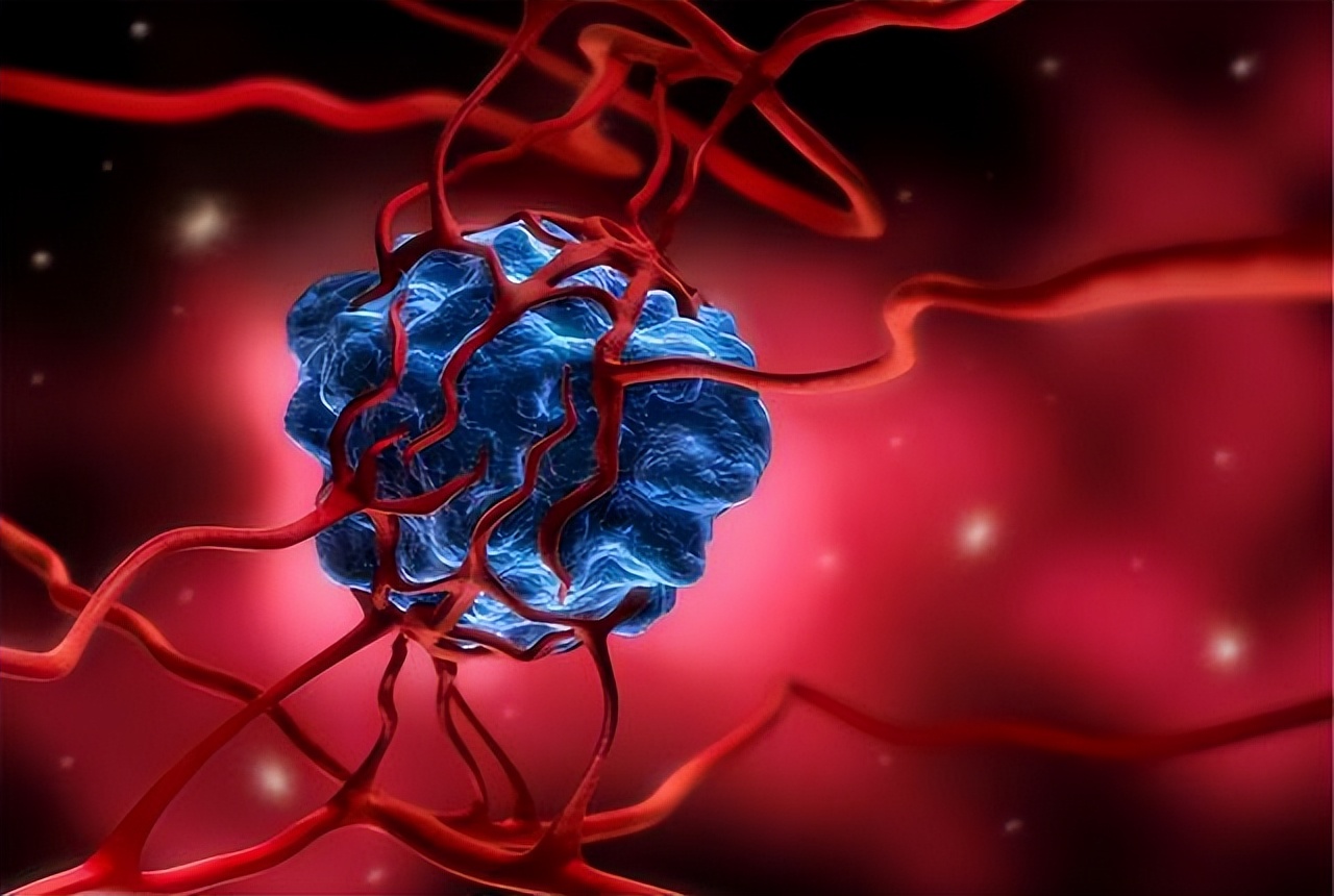 形成囊肿了该怎么把囊肿消下去呢,医生提醒大多数囊肿无需处理