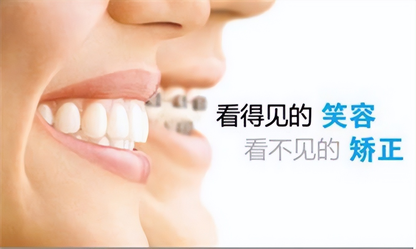 刘春雷昆明,昆明牙齿正畸矫正