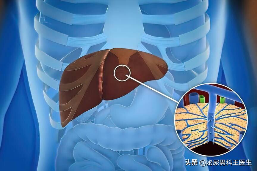 肝硬化失代偿期浑身瘙痒吃什么药,皮肤瘙痒检查竟是肝脏问题