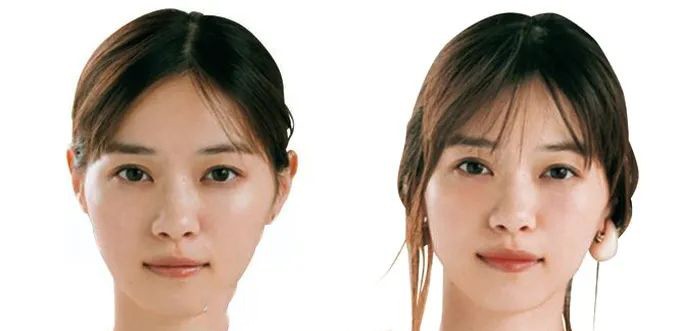 下巴短和后缩怎么变美,下巴后缩怎么矫正嘴尖