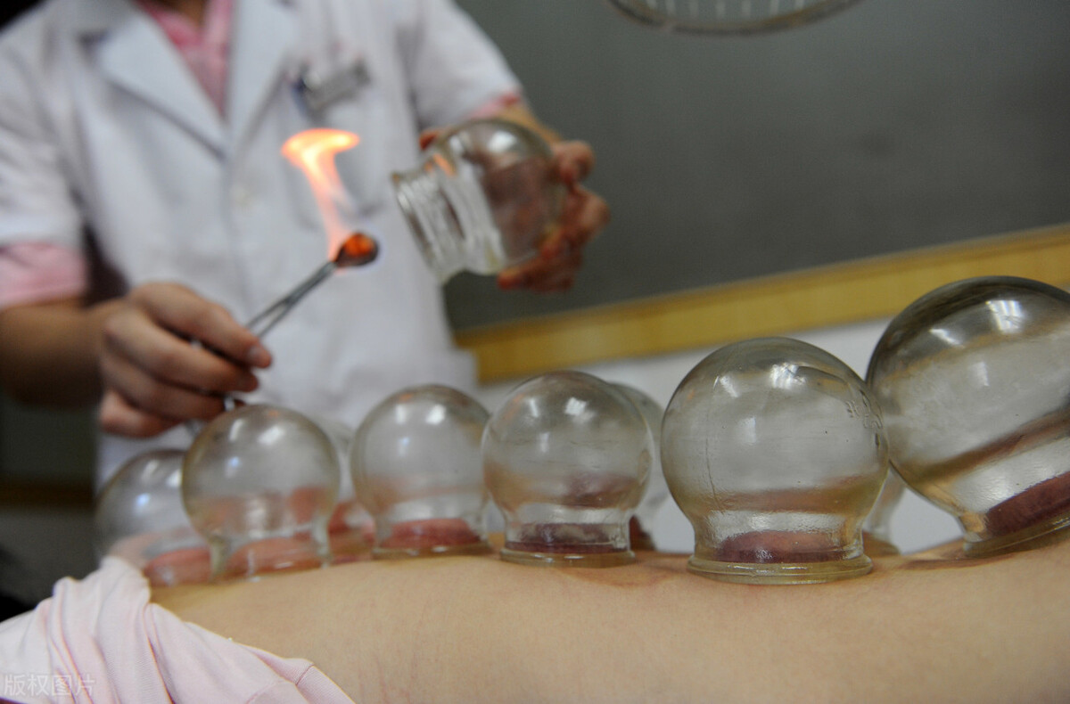 拔火罐吸出来的瘀血是毒素吗,拔完火罐后背上吸出来的瘀血