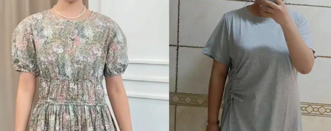 富贵包真的很丑吗,有富贵包会影响寿命吗