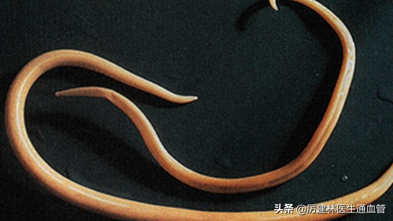 宝塔糖除了除虫还可以干嘛,宝塔糖除虫的药七十年代