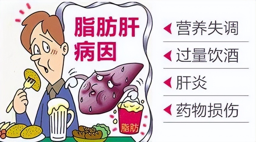 高血脂合并脂肪肝用什么药好,血压高血脂稠脂肪肝需要检查什么