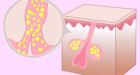 高考女生为什么口服避孕药,女生吃避孕药有什么反常