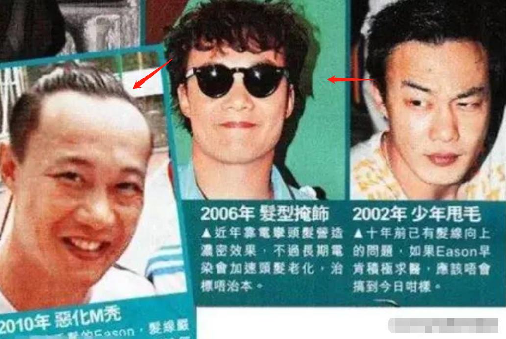 发际线秃的男星,盘点十大秃头男星佩戴假发