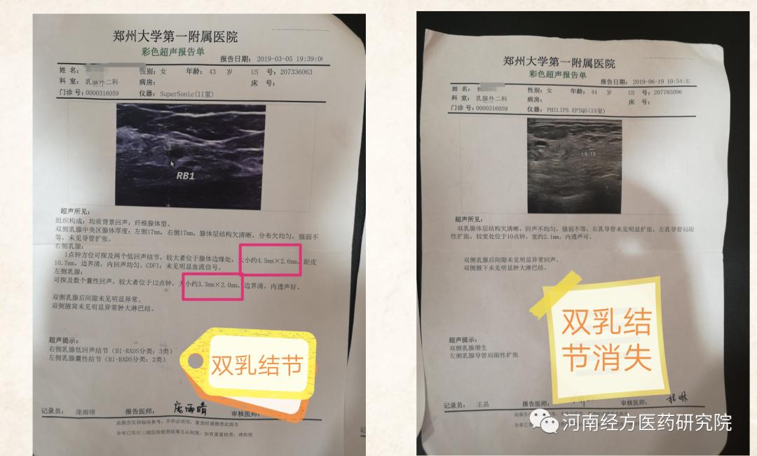 甲状腺结节乳腺增生经方案例,王付教授谈结节