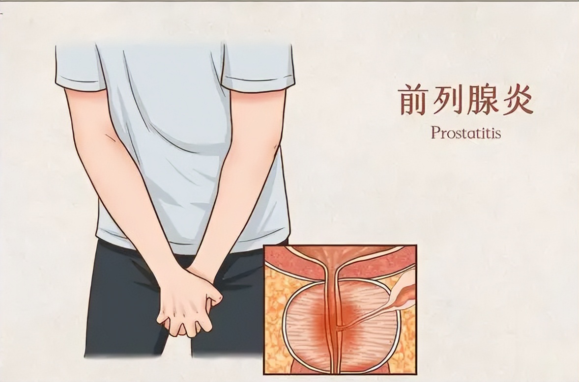 总感觉尿不尽还有点疼是什么情况,总感觉尿不尽怎么回事