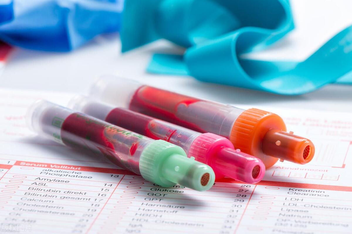 做试管婴儿为什么要每天都要打针,做试管婴儿时会体检抽血吗