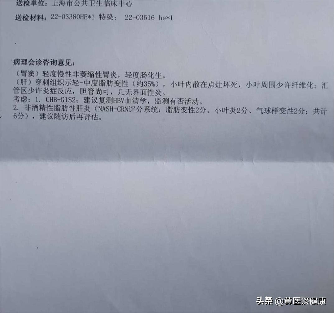 乙肝早期肝硬化伴有脂肪肝严重吗,乙肝肝硬化伴有脂肪肝严重吗