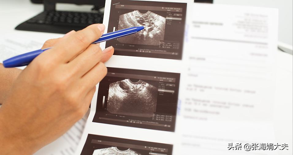 怎么样才能快速怀孕四个小技巧,怎么能快速怀孕专家教你几招